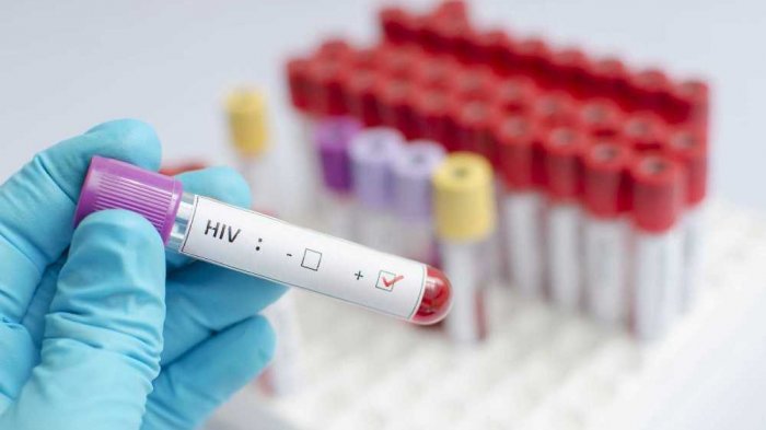 Stadium Awal HIV Tidak Tunjukkan Gejala, Dokter Ingatkan Perlu Edukasi pada Masyarakat 